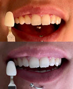 FORMATION BLANCHIMENT DENTAIRE COSMÉTIQUE 1 jour